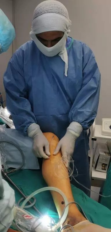 doktor endoskopska operacija vena